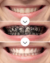 Cargar imagen en el visor de la galería, Blanqueador Dental de Carbón Activado — Sonrisa Más Luminosa en Casa

